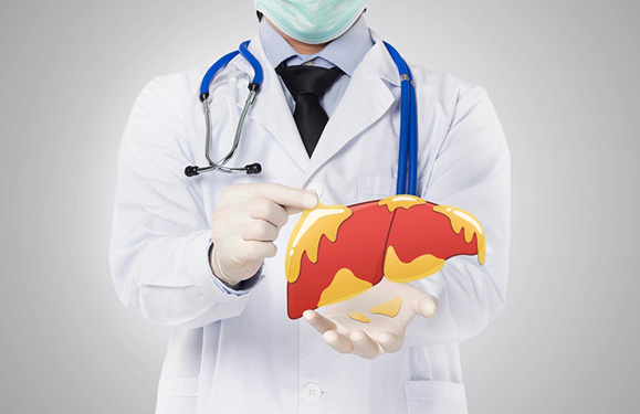 Fatty Liver